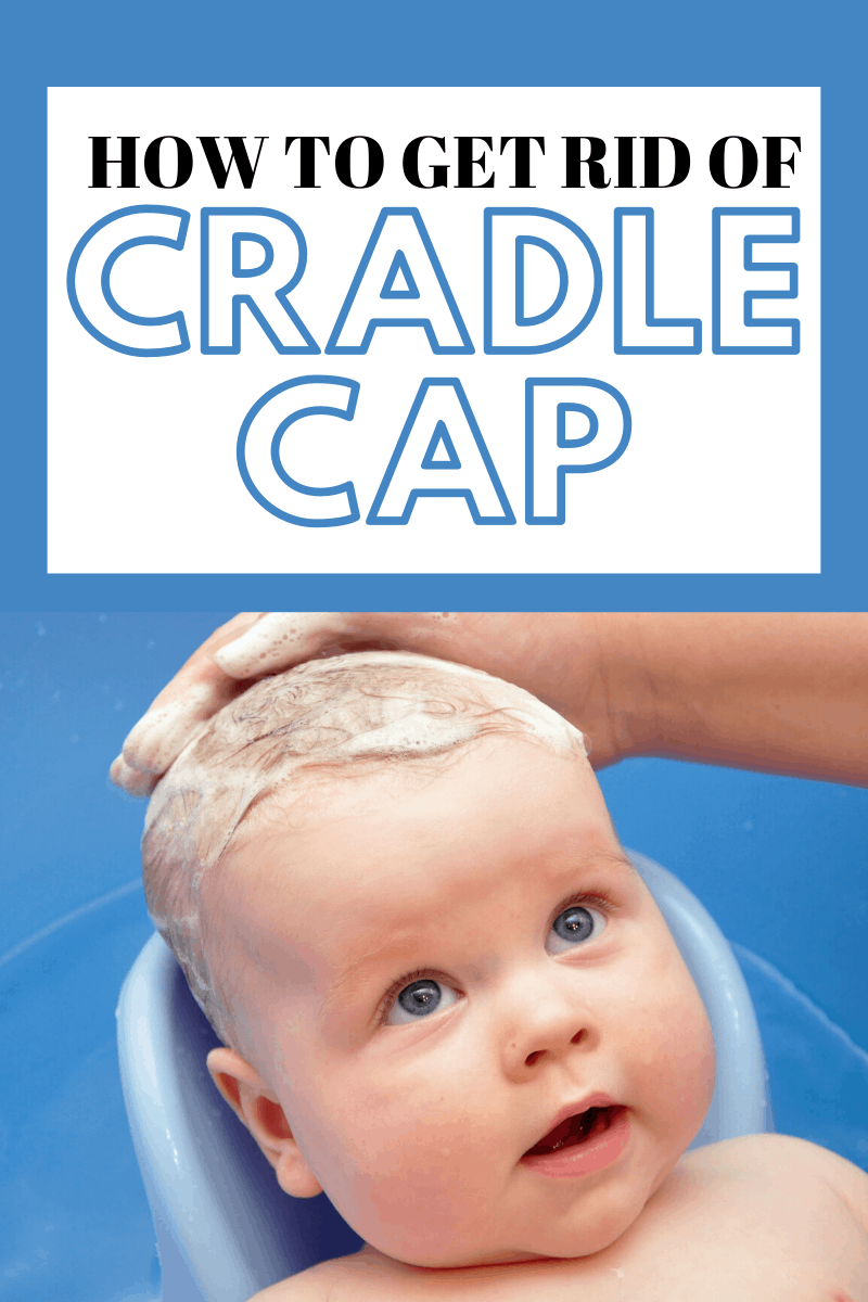 Cradle Cap Home Remedies To Get Rid Of It Oh Baby Love